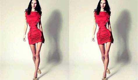 Удивительная жизнь самого худого человека в мире